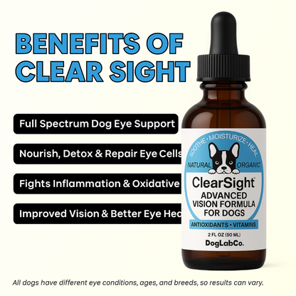 ClearSight™ Advanced Vision Formula